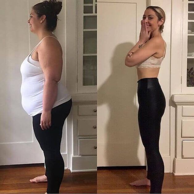 Femme avant et après avoir pris Ablim